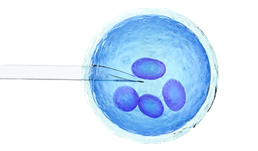 IVF