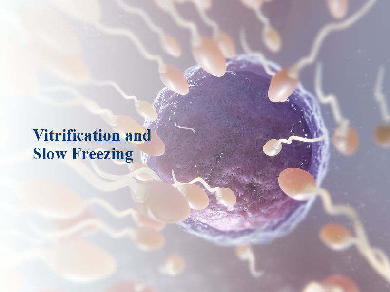 Vitrification and Slow Freezing