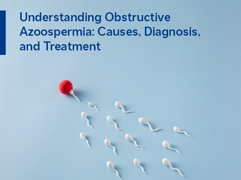 Understanding Obstructive Azoospermia: Causes, Diagnosis, and Treatment