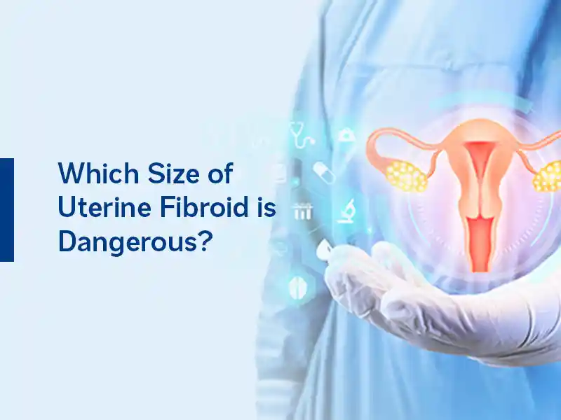 Which Size of Uterine Fibroid is Dangerous?